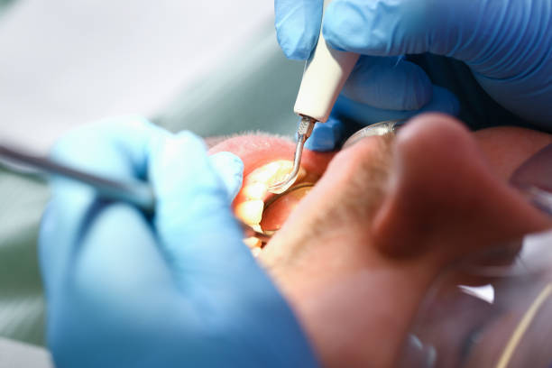 Best Emergency Dental Care for Trauma or Injury in Damascus, MD
